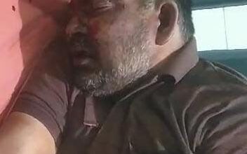 Photo of ई-रिक्शा चालक को लाठी-डंडे और कुल्हाड़ी से पीटा, कानपुर रेफर