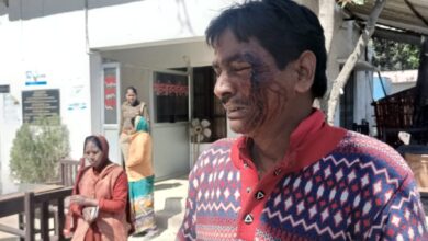 Photo of रंजिश में दबंगों ने मजदूर को पीटा मुकदमा दर्ज