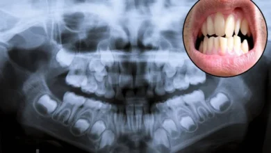 Photo of हाथी के दांत साबित हो रही एक्स रे मशीन
