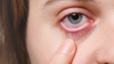 Photo of कोविड के बाद 40 फीसद बच्चों में बढ़ रही है आंखों की बीमारी